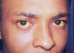 ojos amarillos