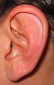 Remedios caseros para los zumbidos en los oídos